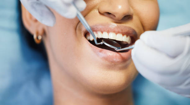 Best Urgent Care for Lost Fillings or Crowns in Silver Lake, KS